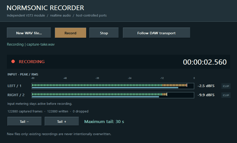 Tatsächliche native Oberfläche · NORMSONIC RECORDER